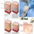 Giảm mỡ bụng sau sinh cho các mẹ an toàn đến trẻ nhỏ
